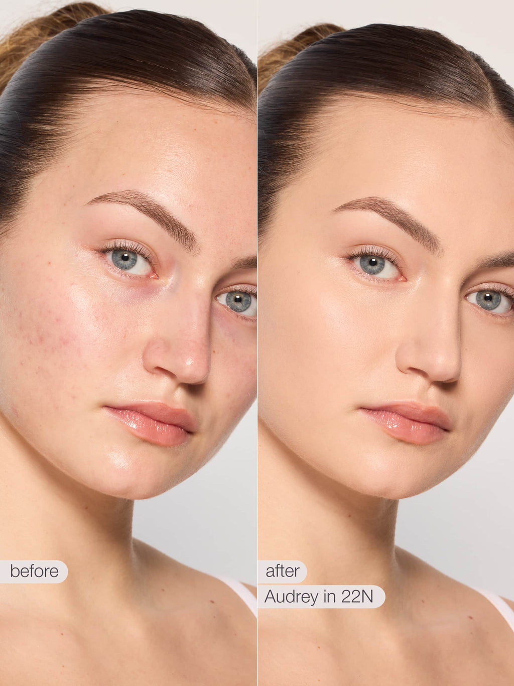 Before and after comparison of a woman's face with skin treatment product application. using tarte shape tape concealer