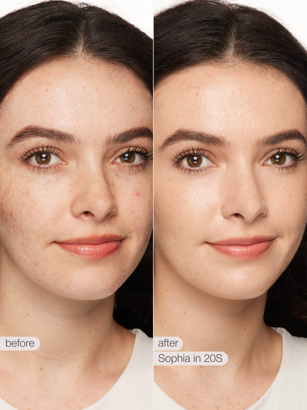Before and after comparison of a woman's face with text indicating 'before' and 'after' with 'Sophia in 203'.