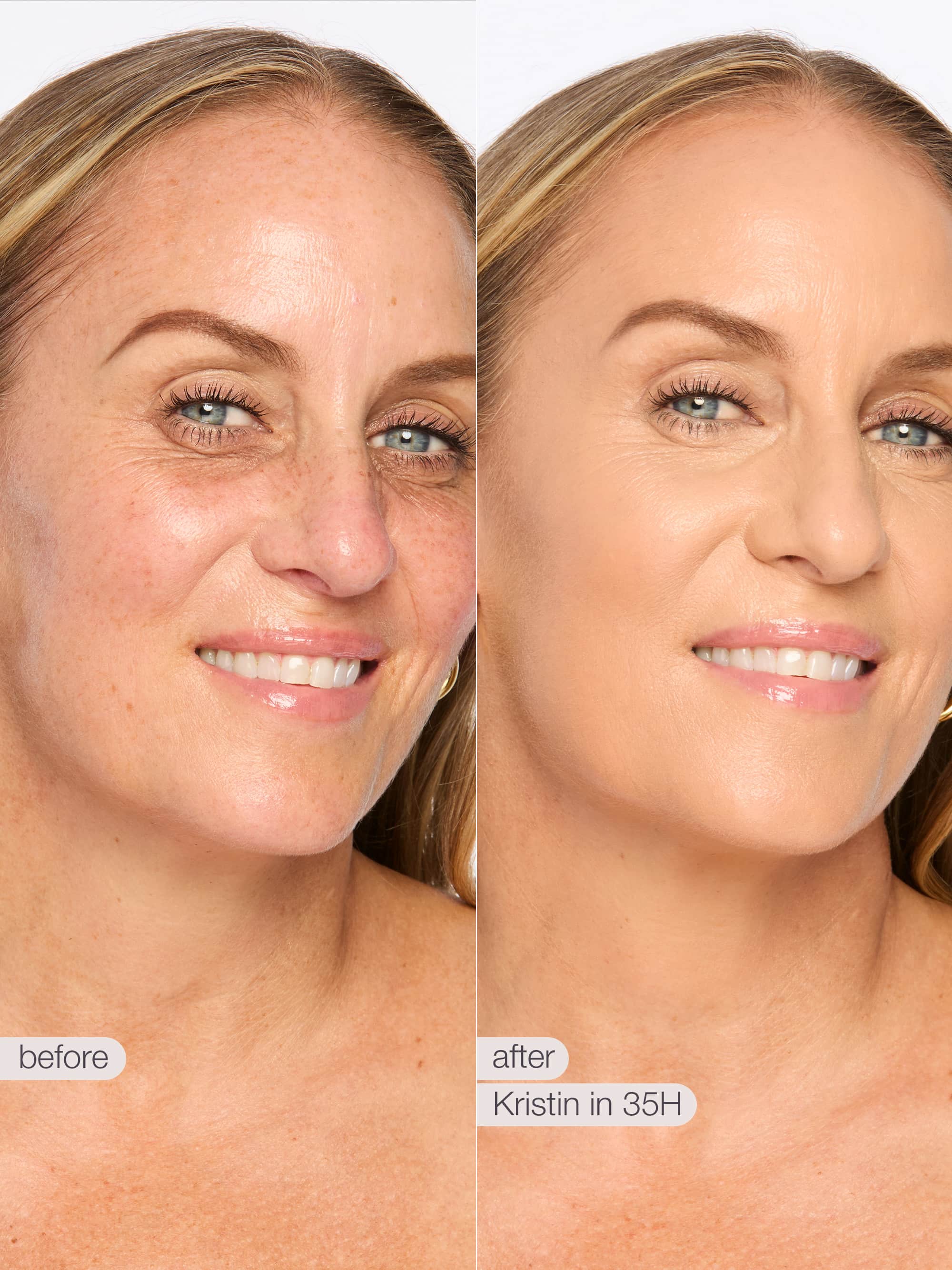 Before and after comparison of a woman's face with visible skin improvement. using tarte shape tape concealer