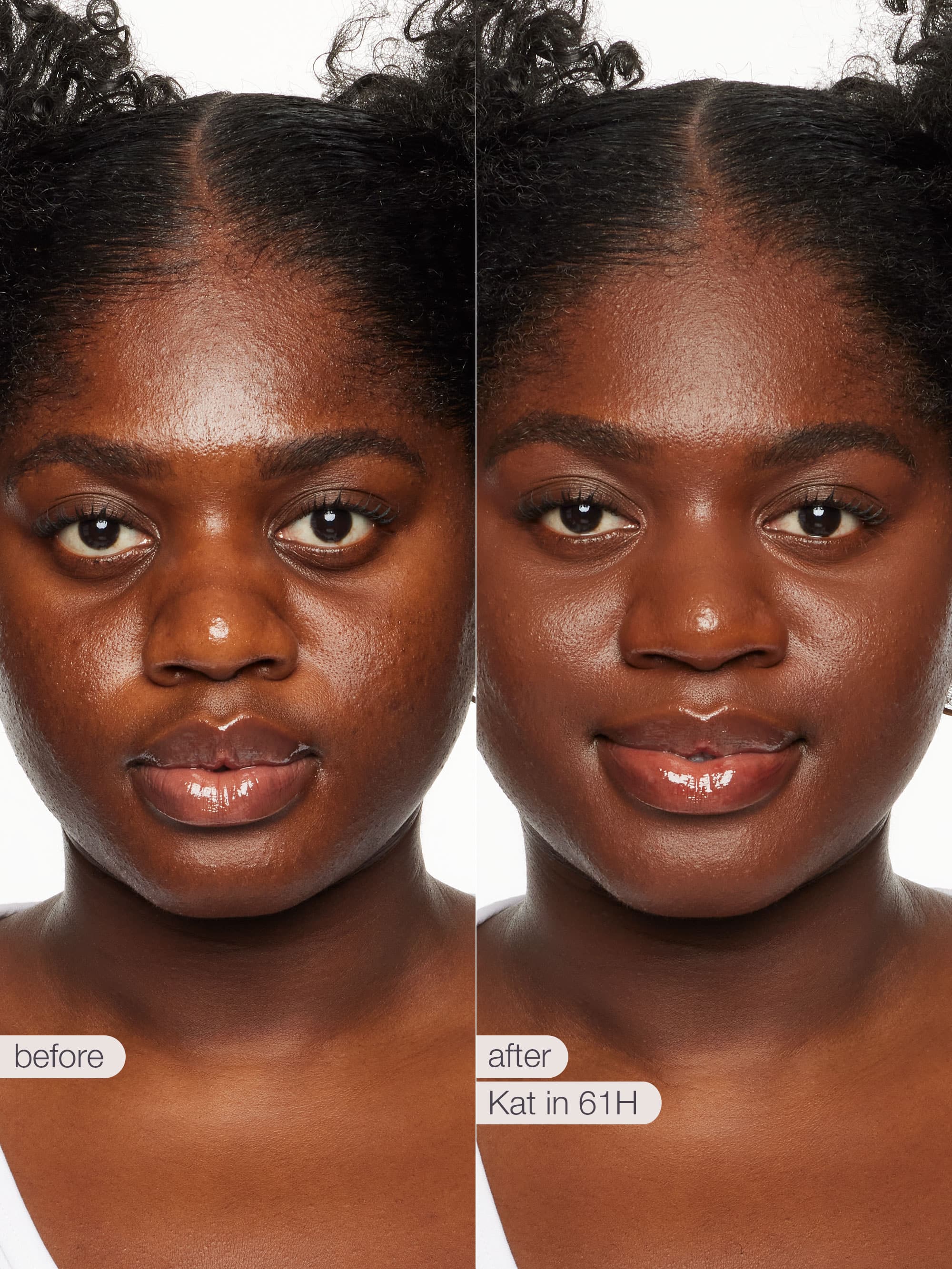 Before and after comparison of a woman's face with 'before' and 'after' labels on a white background.